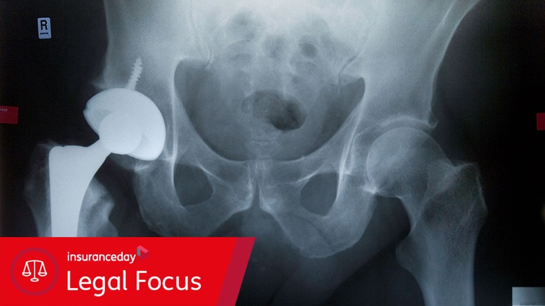 Hip replacement (A ROOM WITH VIEWS/Alamy Stock Photo)